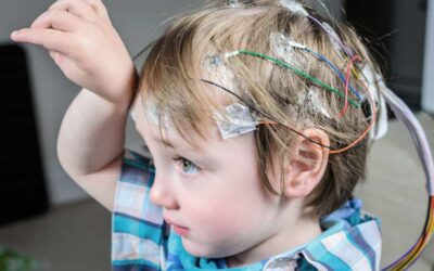 A Little Child Becomes The World’s First Person To Get Brain Implants That Treat Epilepsy