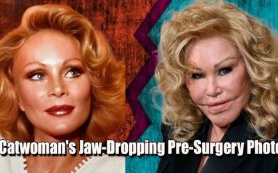 ‘Catwoman’ Jocelyn Wildenstein Shows Her Natural Visage In A Stunning Throwback Shot